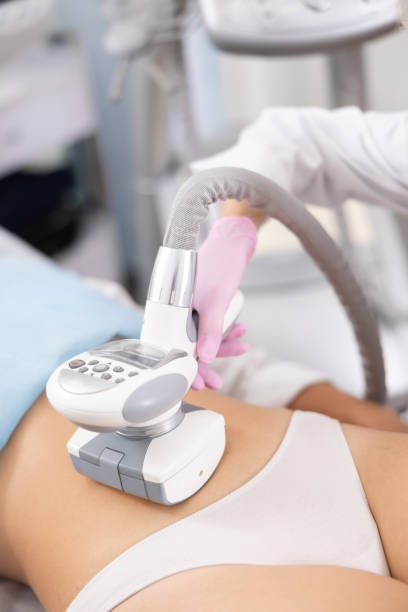 istock LPG massage device applied on young woman's belly 1483139536