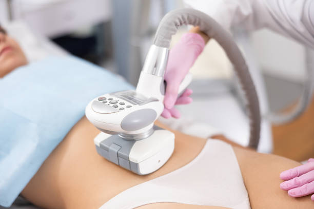 istock LPG massage device applied on young woman's belly 1483139539