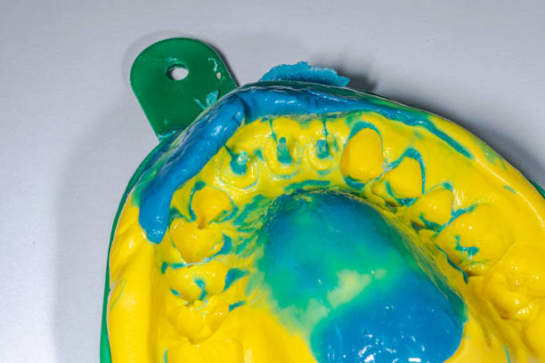 istock Maxillary arch impression with double silicone material on a metallic tray f 1483143558