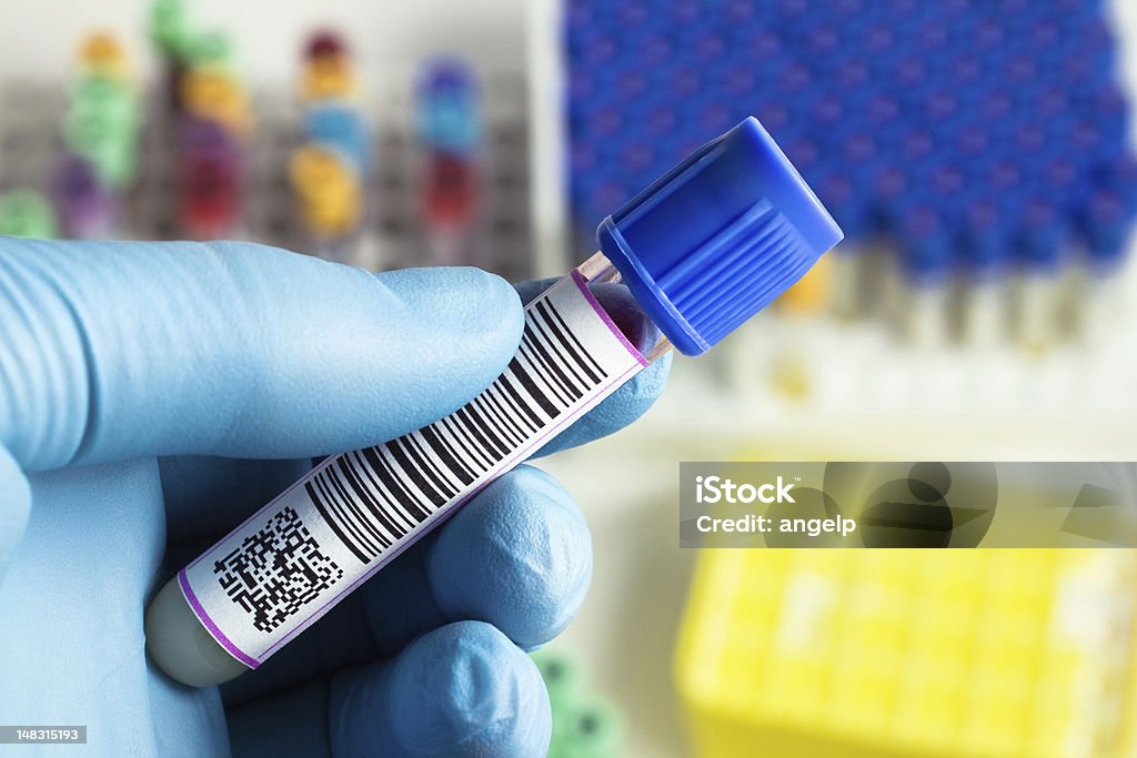 hand holding a tube of blood hand of a technician holding a tube of blood in a laboratory Label Stock Photo