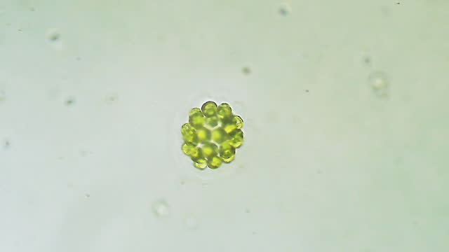 Volvox - colonial micro organism algae