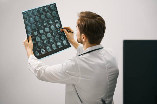 istock Doctor analyzes examines an MRI scan of the brain 1483306162