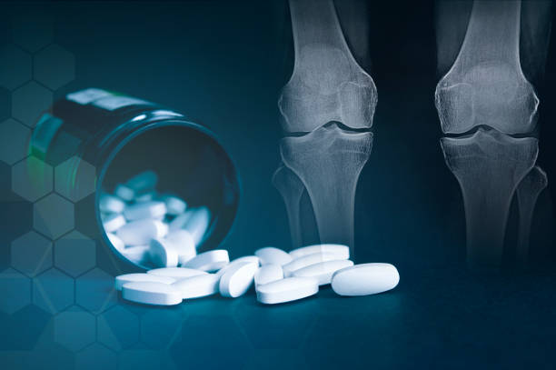 Glucosamine Chondroitin MSM is a drug for joints and ligaments. stock photo