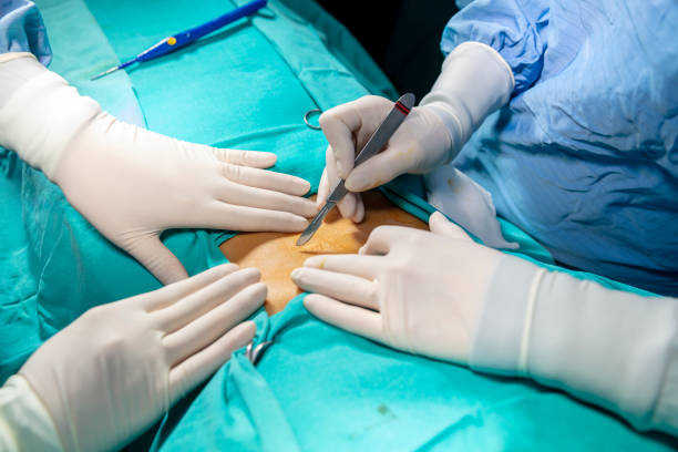 istock Doctor hands performing surgery in hospital 1483352764