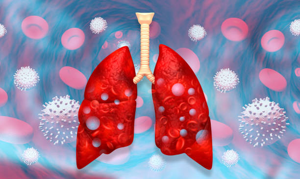 istock Human lungs with corona virus 1483498386