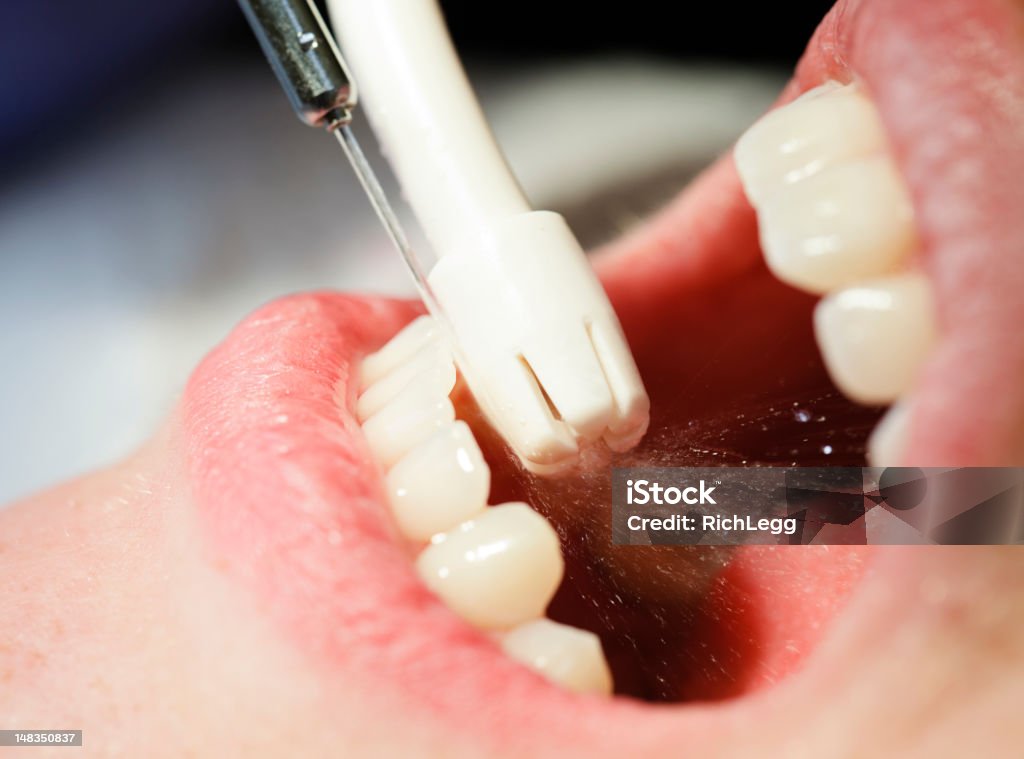 Gros plan de nettoyage dentaire - Photo de Dentiste libre de droits