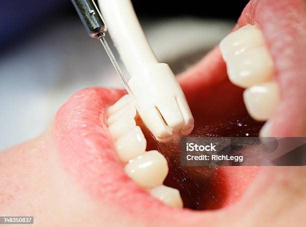 Photo libre de droit de Gros Plan De Nettoyage Dentaire banque d'images et plus d'images libres de droit de Dentiste - Dentiste, Eau, Équipement dentaire
