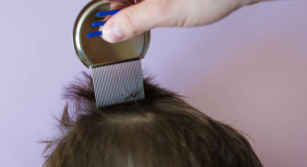 istock Lice comb and brunette hair copyspace 1483523910