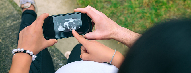 Top view of unrecognizable pregnant woman looking ultrasound scan of her baby on phone with her couple sitting on nature