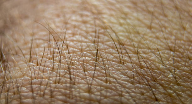 istock Macro human skin texture. Closeup skin pattern. Medicine healthy surface background. Dermatitis concept 1484061262