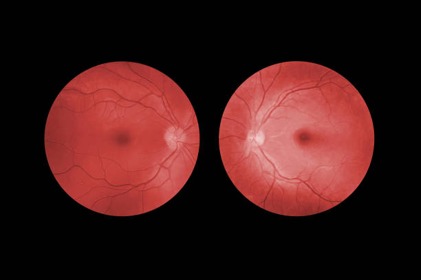 istock Human eyes retina, professional ophthalmological equipment. 1484652337