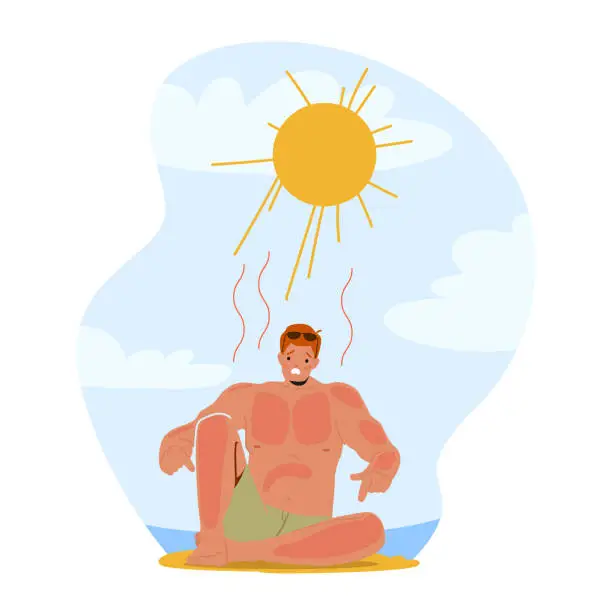 Vector illustration of Man Grimacing In Pain From Sunburn On Beach, Red And Inflamed Skin, Seeking Relief And Shade From The Scorching Sun