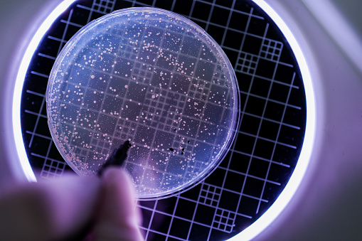 Hand Holds Petri Dish with Bacteria Culture