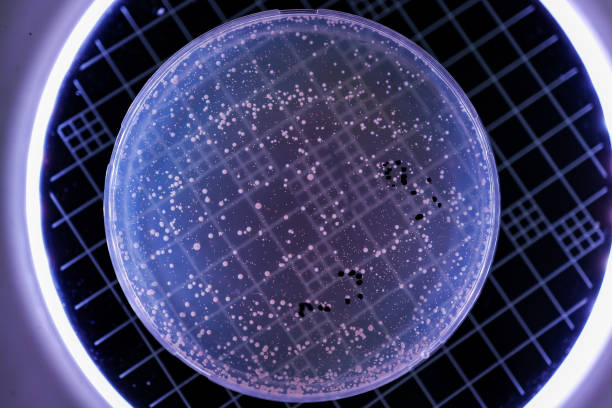 istock Hand Holds Petri Dish with Bacteria Culture 1485082181