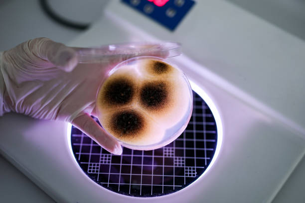 Hand Holds Petri Dish with Bacteria Culture