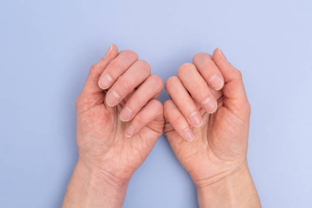 primo piano di due mani femminili con unghie naturali, cuticola invasa su sfondo blu. cura delle mani e delle unghie. - brittlebush foto e immagini stock