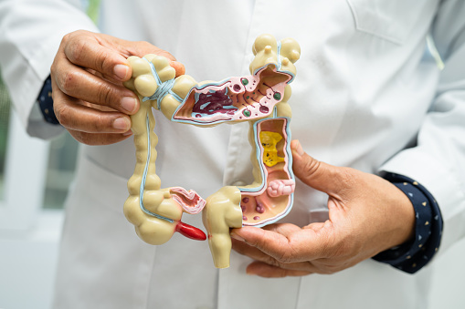 Usus Usus Buntu Dan Sistem Pencernaan Dokter Memegang Model Anatomi
