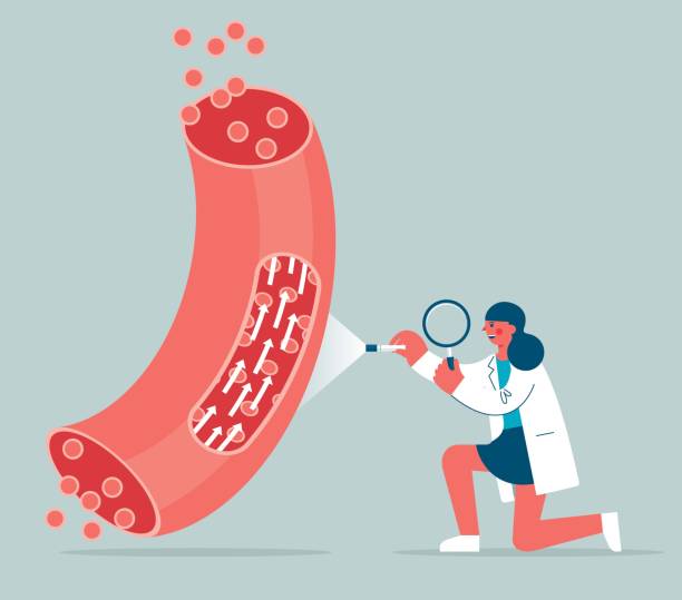 naczynie krwionośne - szkło powiększające - lekarz - cholesterol atherosclerosis human artery illness stock illustrations
