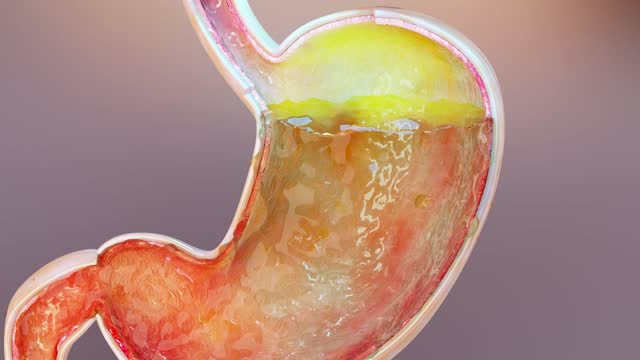 human stomach with gases. Bloating and flatulence, flatulence and gastrointestinal tract, Bloating digestion system, stomach ache or cramps, gastritis, stomachache, indigestion, vomiting, 3d render