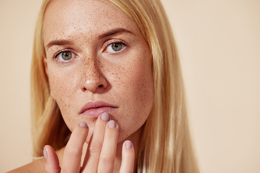 Close up of a woman with freckles touching her lip with a finger. Young blond female applying balm on her lips.