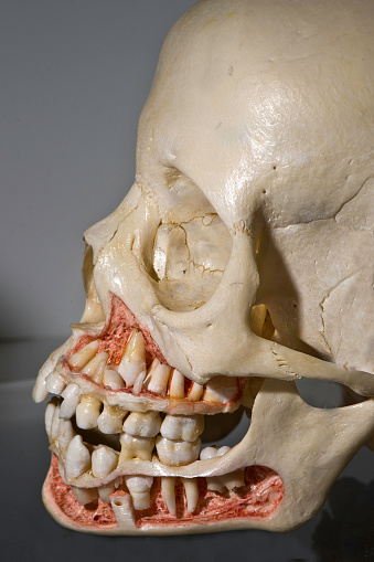 Human skull of about a 11 to 12 year old showing developing and erupting teeth.
