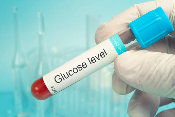 el científico sostiene un tubo de muestra de prueba de glucosa, diagnóstico de hiperglucemia o hipoglucemia. comprobación del nivel de glucosa en sangre. concepto de pruebas médicas. - hyperglycemia fotografías e imágenes de stock