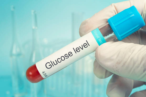 les scientifiques tiennent un tube échantillon de test de glucose, diagnostic d’hyperglycémie ou d’hypoglycémie. vérifier le taux de glucose dans le sang.. concept de tests médicaux. - hyperglycemia photos et images de collection