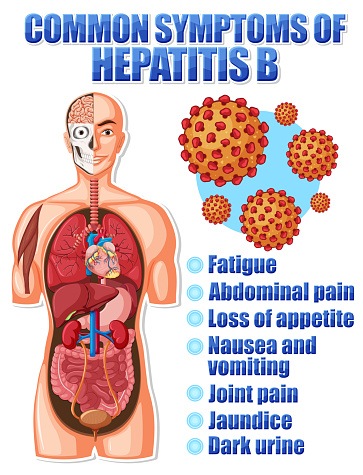 Hepatitis B Rash Back Informative Poster Of Common Symptoms Hepatitis B Stock Illustration ...