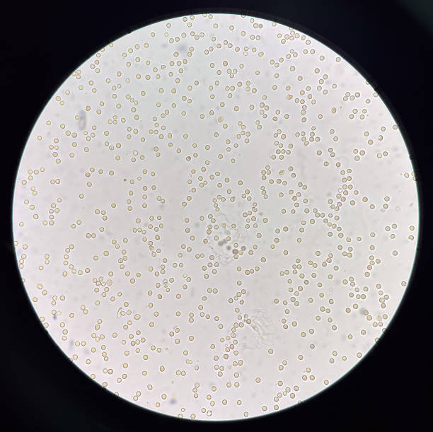istock Fresh red blood cell in urine. 1486033334