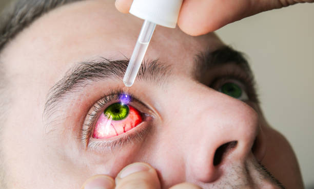 istock Man is putting drops in his eyes. Medical treatment concept. Allergic conjunctivitis problem. 1486234723