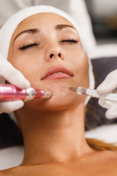 istock Dermapen Micro-needling Treatment In A Beauty Salon 1486283385
