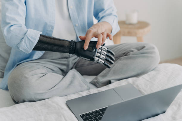 istock Handicapped woman with artificial arm working on laptop at home. Setting up bionic prosthesis. 1486490715