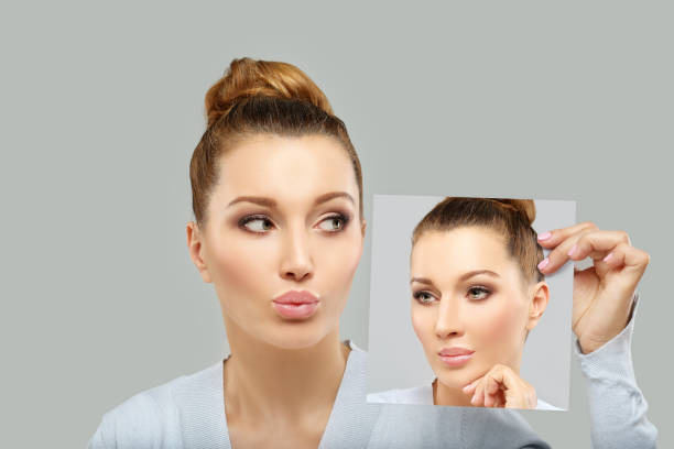 istock Rhinoplasty.Before and after 1486606782