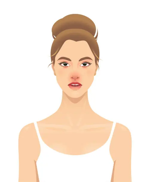 Vector illustration of Young woman with allergy