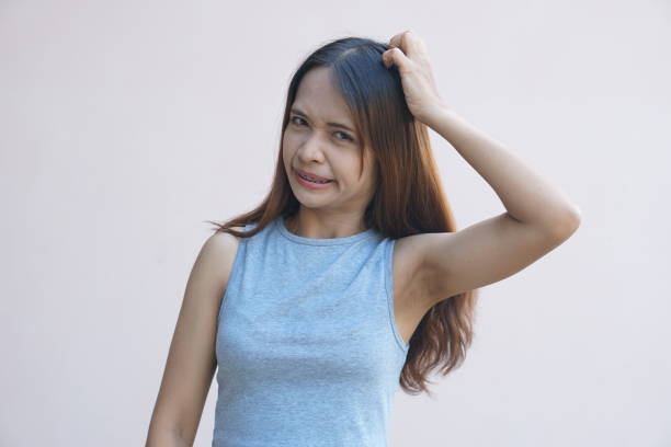 istock Asian woman having itchy head from dandruff 1486933278