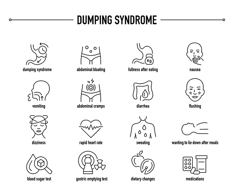 Dumping Syndrome symptoms, diagnostic and treatment vector icons
