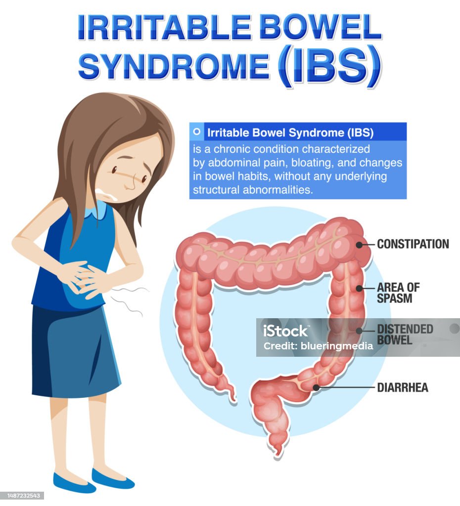 Constipated Computer Irritable Bowel Syndrome Infographic Stock Illustration - Download ...