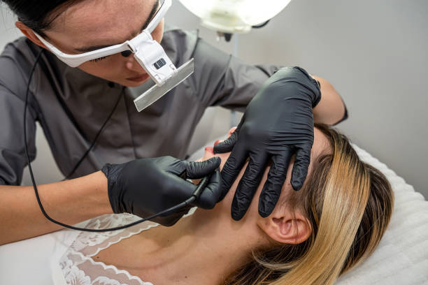 istock Dermatologist using an electroepilation device for hair removal on face her young woman client at medical cabinet 1487280390