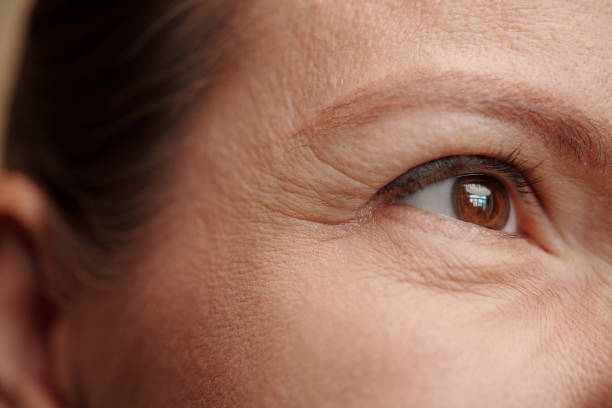 Eye Wrinkles and Skincare stock photo
