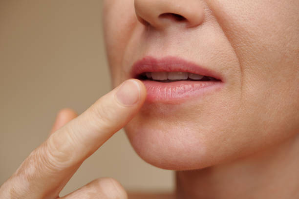 istock Woman Applying Hydrating Lip Teatment 1487309293