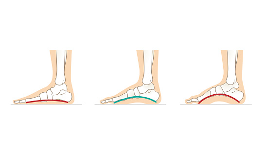 Normal Feet Angle Normal Feet Flat Feet High Arch Feet Stock Illustration - Download ...