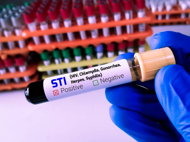 biochemist or lab technologist holds blood sample for sti or sexually transmitted infection test with laboratory background. - sti imagens e fotografias de stock