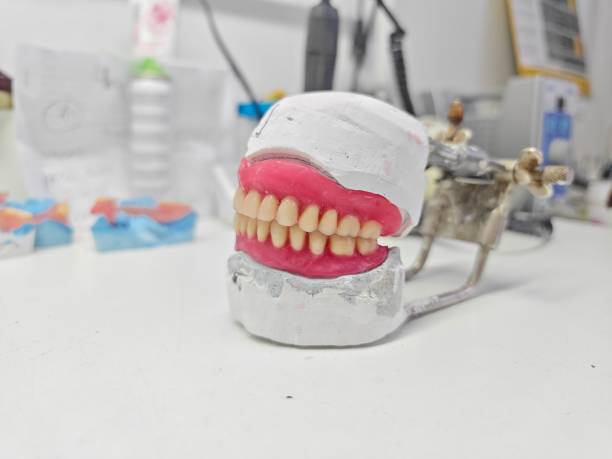 istock Removable dentures for the patient are made in  dental laboratory 1487885358