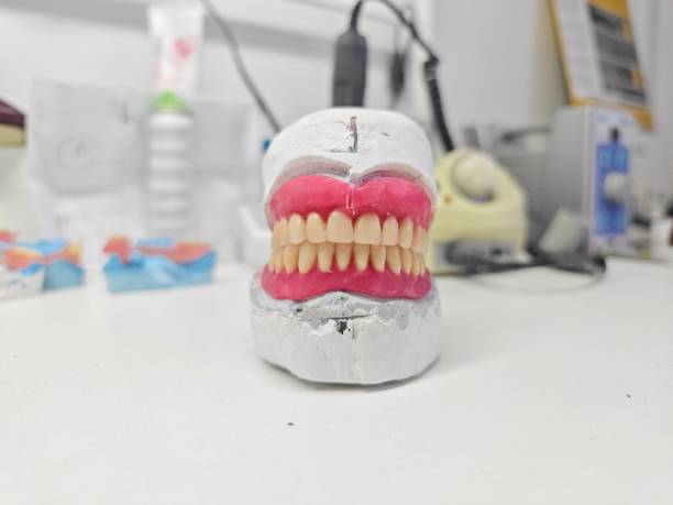 istock Removable dentures for the patient are made in  dental laboratory 1487885362