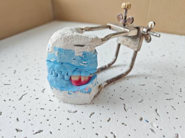 istock Removable dentures for the patient are made in  dental laboratory 1487885377