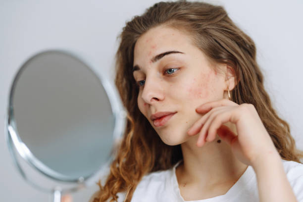 istock Young woman  with problem skin looking into mirror. 1487914194