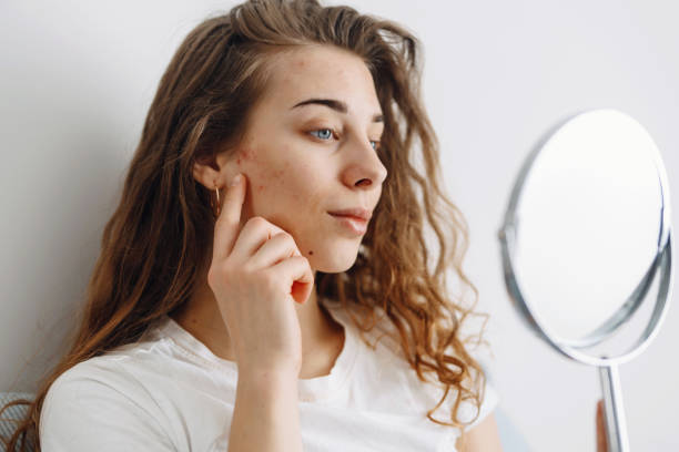 istock Young woman  with problem skin looking into mirror. 1487914199