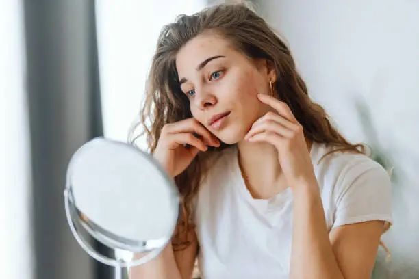 Young woman  with problem skin looking into mirror.