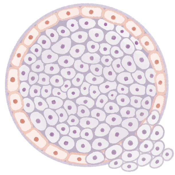 illustrazioni stock, clip art, cartoni animati e icone di tendenza di carcinoma duttale invasivo (idc) diagramma del cancro al seno - lactiferous duct