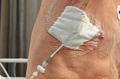A bandage over a drain for a  pneumothorax or  commonly known as a collapsed lung.
